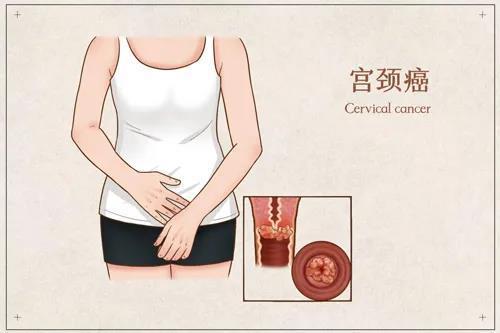 下载.jpg