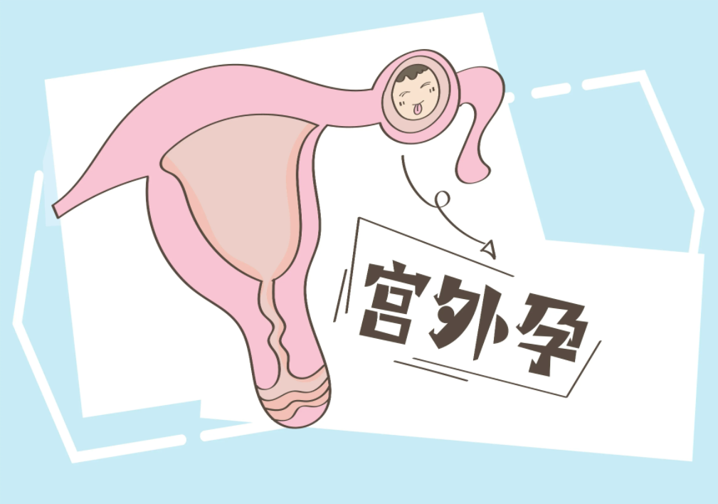 QQ截图20220612100557.png